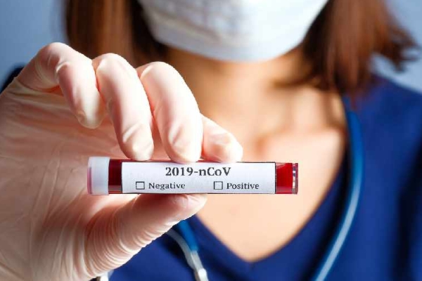 В ОАЭ за сутки зафиксировано 564 новых случаев заражения коронавирусом 